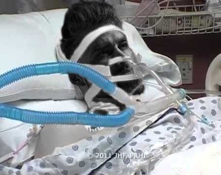 GigaChad's face on a hospital patient.